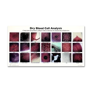 Dried Blood Cell Analysis Chart